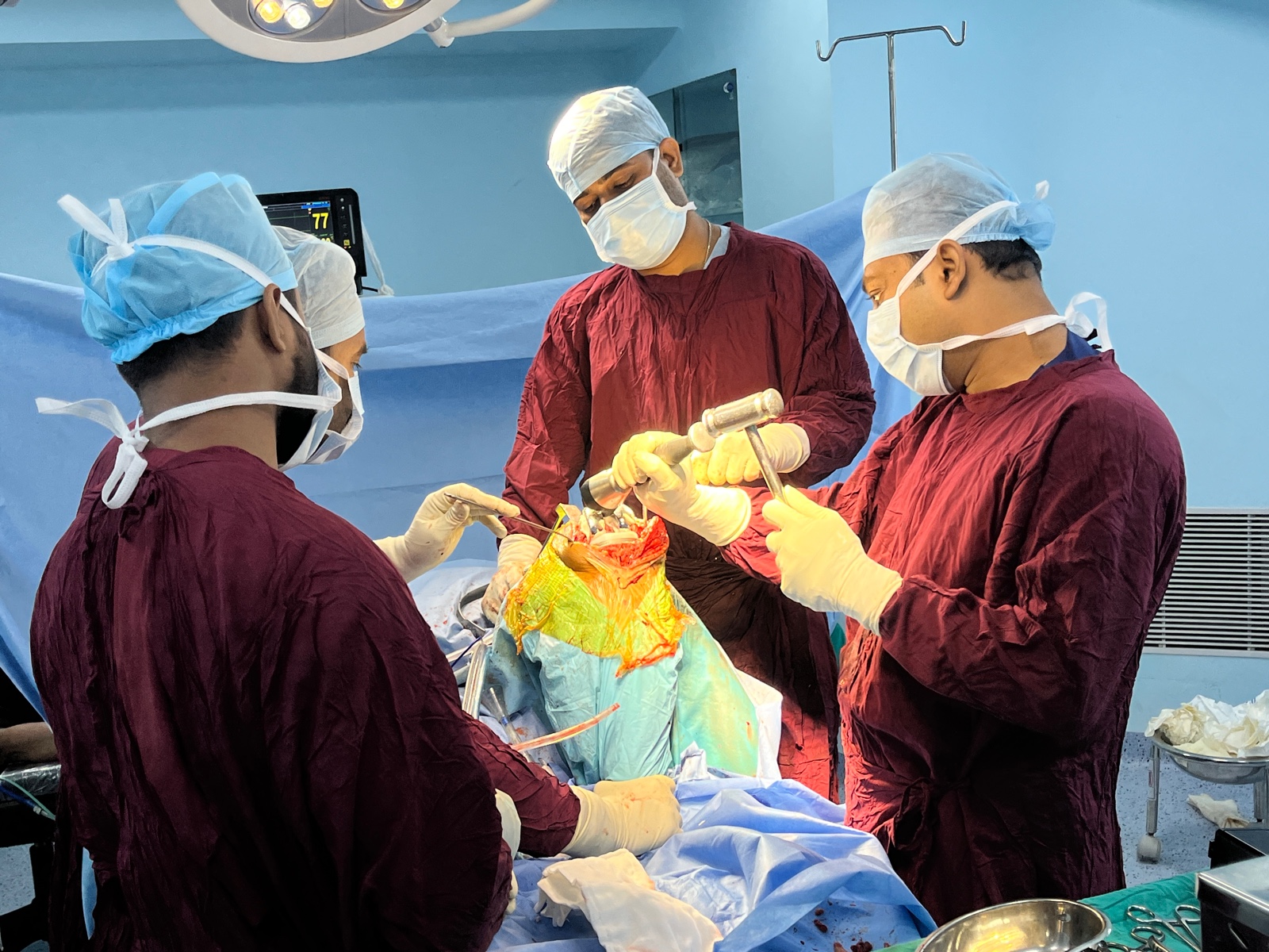 Operation
